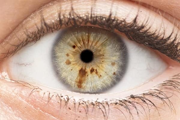 maladie de la retine pigmentaire maladie du vitre centre ophtalmologie popp15 centre ophtalmologique pathologies oeil et paupieres paris 15